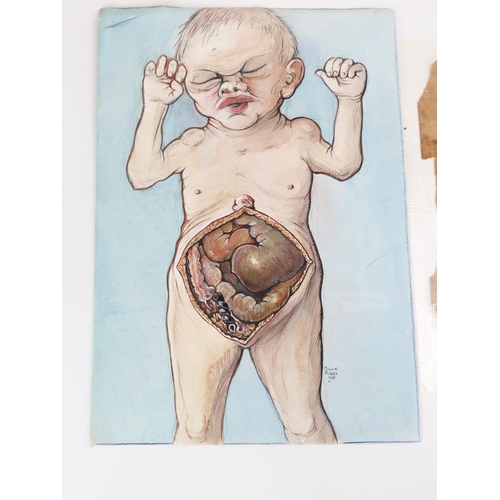 1307 - Dulcie Pillers. Two anatomical watercolours of children's abdomens, signed and dated 1951 36 x 25cm ... 