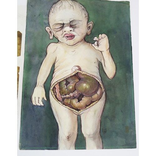 1307 - Dulcie Pillers. Two anatomical watercolours of children's abdomens, signed and dated 1951 36 x 25cm ... 