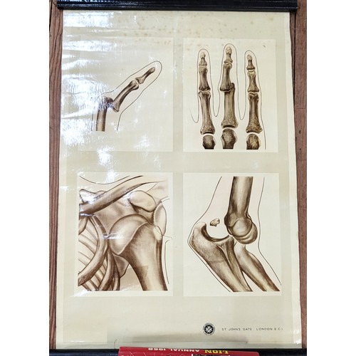 94 - St John's Ambulance educational poster: 'Dislocation' 76cm x 60cm, 'Fractures' 88cm x 54cm (damage t... 