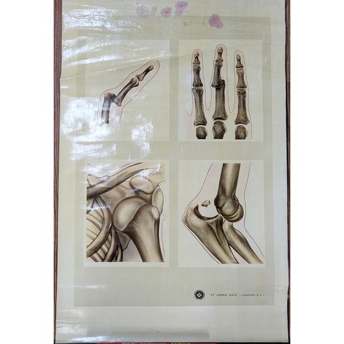 96 - St John's Ambulance educational poster: 'Dislocation' (stained) 88cm x 54cm