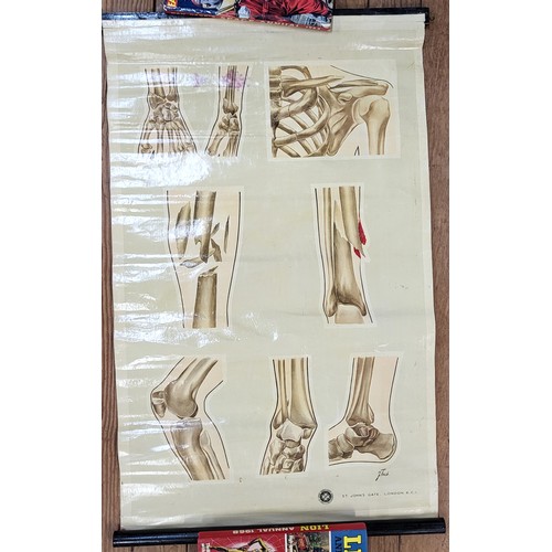 101 - St John's Ambulance educational poster: 'Fractures (stained) 87cm x 54cm