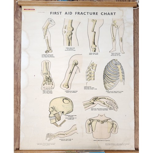 94 - St John's Ambulance educational poster: 'Dislocation' 76cm x 60cm, 'Fractures' 88cm x 54cm (damage t... 