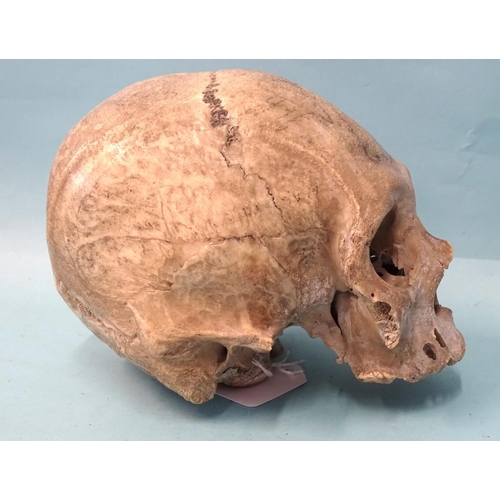 450 - An antique human skull, (a/f, lower mandible and zygomatic arches lacking).