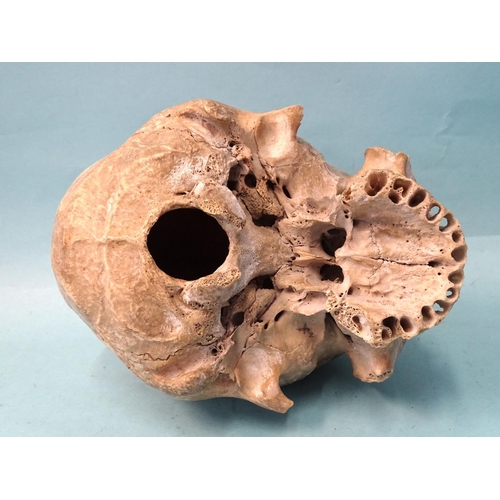 450 - An antique human skull, (a/f, lower mandible and zygomatic arches lacking).