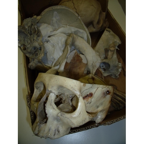 60 - Medical research dissected sectional human skull, another human skull, a selection of various human ... 