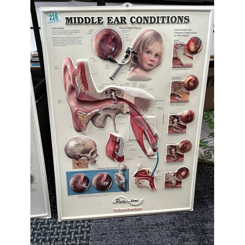 228 - 2 x Ear Medical Charts, middle ear conditions & ear organs of hearing & balance - by The Happiest So... 