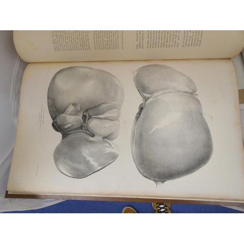 143 - QUAIN JONES & WILSON W. J. ERASMUS.  The Viscera of the Human Body ... in a Series of ... 