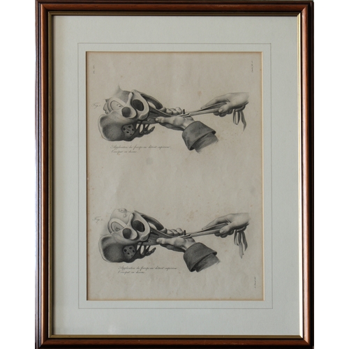 908 - After Antoine Chazal (French, 1793-1854)A group of French anatomical/pregnancy studies, prints, 26.5... 