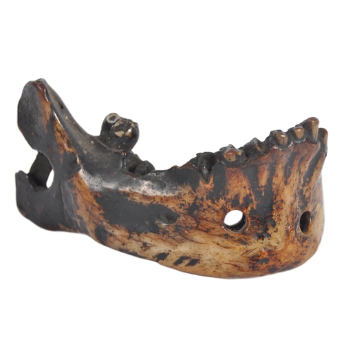 178 - A 19th century Nepalese witch doctors amulet. In the form of a human lower jaw, of charred and lacqu... 