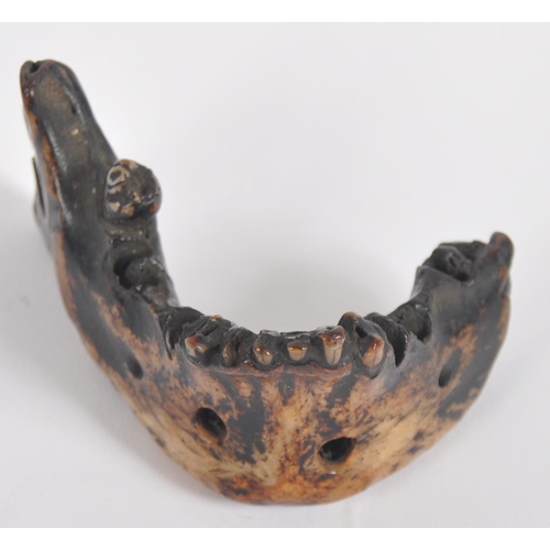 178 - A 19th century Nepalese witch doctors amulet. In the form of a human lower jaw, of charred and lacqu... 