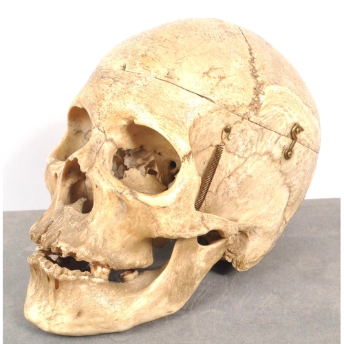 202 - Anatomy / Medical Interest - An early 20th century Edwardian female human skull. The skull having br... 