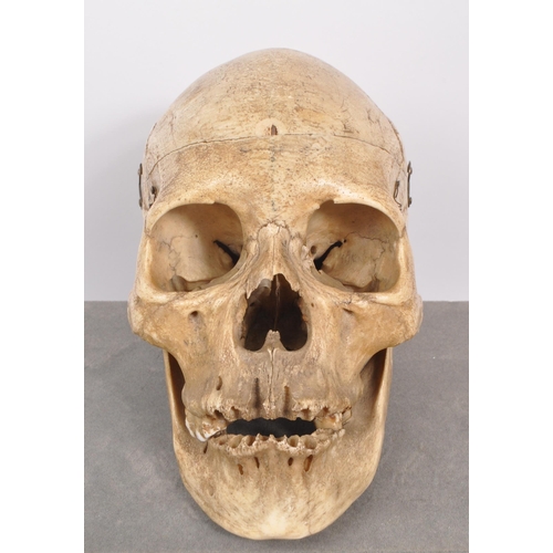 202 - Anatomy / Medical Interest - An early 20th century Edwardian female human skull. The skull having br... 