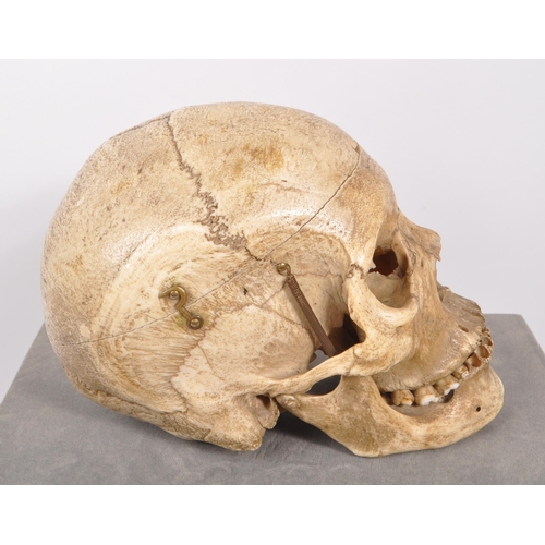 202 - Anatomy / Medical Interest - An early 20th century Edwardian female human skull. The skull having br... 