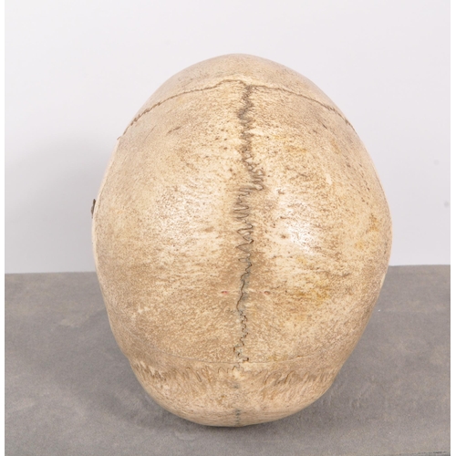 202 - Anatomy / Medical Interest - An early 20th century Edwardian female human skull. The skull having br... 