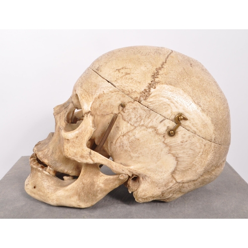 202 - Anatomy / Medical Interest - An early 20th century Edwardian female human skull. The skull having br... 